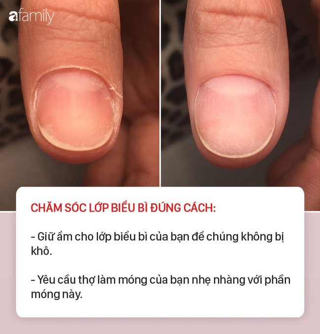 7 bộ phận quan trọng trên cơ thể tuyệt đối cần vệ sinh và chăm sóc đúng cách, nếu không sẽ dẫn đến hậu quả nghiêm trọng - Ảnh 4.