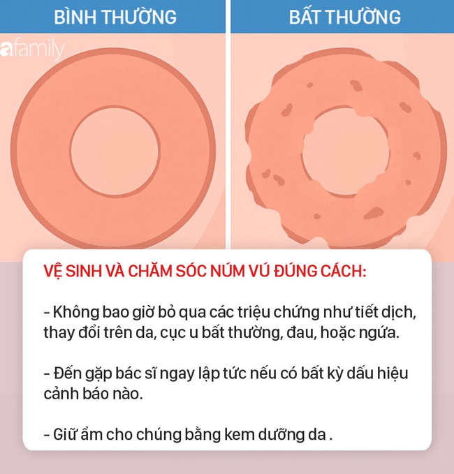 7 bộ phận quan trọng trên cơ thể tuyệt đối cần vệ sinh và chăm sóc đúng cách, nếu không sẽ dẫn đến hậu quả nghiêm trọng - Ảnh 7.