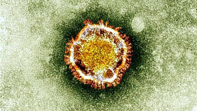 Rùng rợn cơ chế khiến virus corona xâm nhập, biến viêm phổi Vũ Hán thành đại dịch ngay kỳ nghỉ lễ - Ảnh 4.