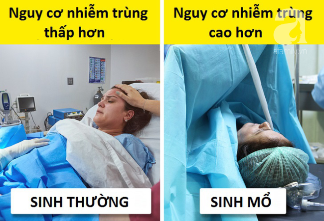 Sinh mổ và toàn bộ những kiến thức cơ bản mẹ cần biết về cuộc đại phẫu: nhiễm trùng, đau đớn, chậm sữa - Ảnh 4. Sinh mổ và toàn bộ những kiến thức cơ bản mẹ cần biết về cuộc đại phẫu: nhiễm trùng, đau đớn, chậm sữa - Ảnh 4.
