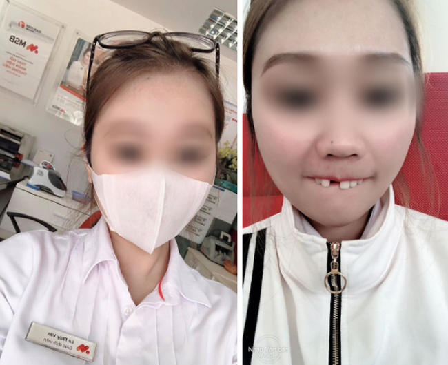 Cắn hướng dương ngày Tết, cô gái trẻ bị... rụng cả răng cửa khiến cộng đồng mạng vừa thương vừa phì cười - Ảnh 2. Cắn hướng dương ngày Tết, cô gái trẻ bị... rụng cả răng cửa khiến cộng đồng mạng vừa thương vừa phì cười - Ảnh 2.