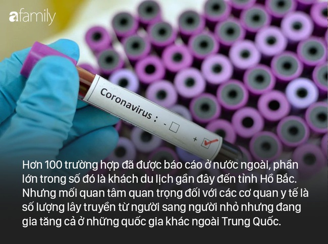 Hoa Kỳ báo cáo trường hợp lây truyền virus corona từ người sang người đầu tiên: WHO lên tiếng &quot;lo ngại nghiêm trọng&quot; về sự lây lan virus từ người sang người ở ngoài Trung Quốc - Ảnh 3.