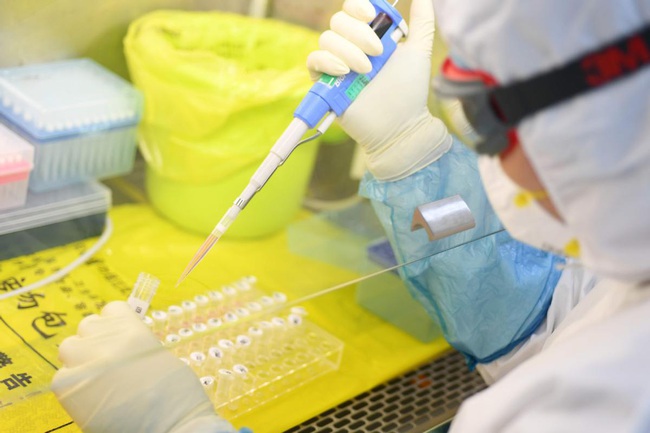 Cập nhật: Số ca nhiễm mới virus Covid-19 tăng gấp 10 lần, số ca tử vong tăng gấp 2, Đại học Bách khoa Hồng Kông phát triển hệ thống chẩn đoán virus trong 1 giờ - Ảnh 2.
