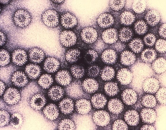 Những loại virus gây chết người kinh khủng nhất mọi thời đại - Ảnh 11.