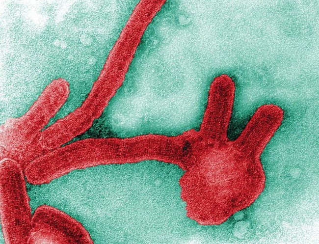 Những loại virus gây chết người kinh khủng nhất mọi thời đại - Ảnh 1.