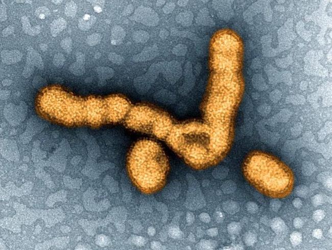 Những loại virus gây chết người kinh khủng nhất mọi thời đại - Ảnh 9.