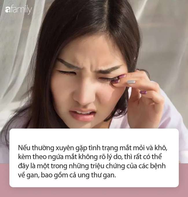 Những người có gan kém sẽ có 3 bất thường trong mắt - Ảnh 1.