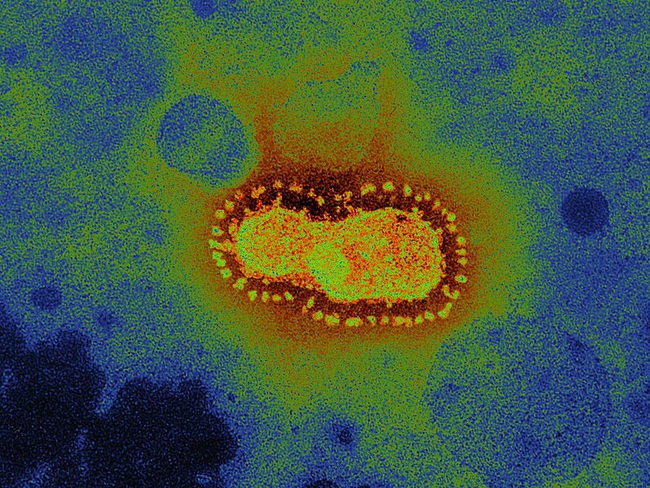 Hơn 50 nghiên cứu về virus corona đăng tải 3 tuần qua: Bạn đã thực sự hiểu đúng về chủng nCOV (2019)? - Ảnh 3.