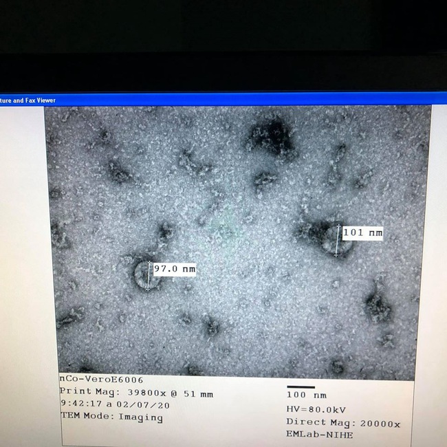 Tin vui: Việt Nam nuôi cấy và phân lập thành công virus Corona mới - Ảnh 2.