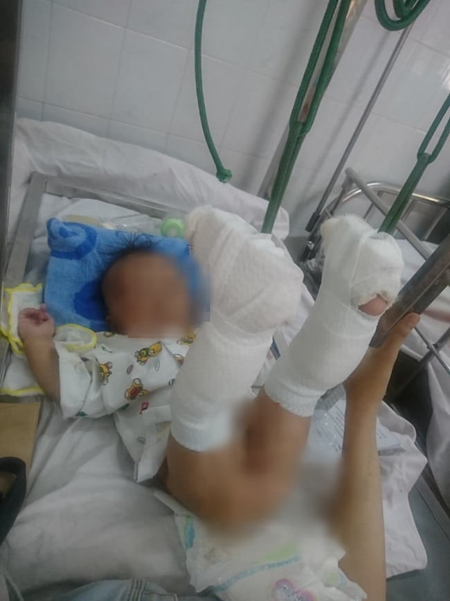 Người bố "dạy dỗ" con đẻ mới 4 tháng tuổi đến mức gãy chân, xuất huyết não ở TP.HCM đối mặt với tội danh gì? - Ảnh 2. Người bố "dạy dỗ" con đẻ mới 4 tháng tuổi đến mức gãy chân, xuất huyết não ở TP.HCM đối mặt với tội danh gì? - Ảnh 2.