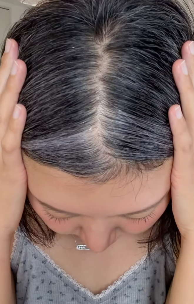  - Ảnh 1.