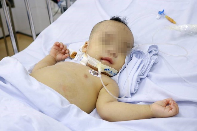 TP.HCM: Bé trai 1 tuổi sốc nhiễm trùng nặng, tiên lượng tử vong 99% được cứu sống - Ảnh 1.