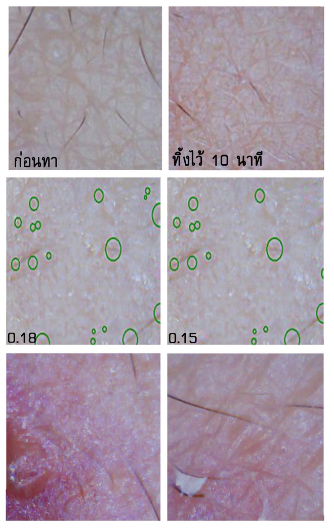 Soi đến tận chân tơ xem hiệu quả của 8 sản phẩm chống lão hóa phổ biến hiện nay - Ảnh 18.