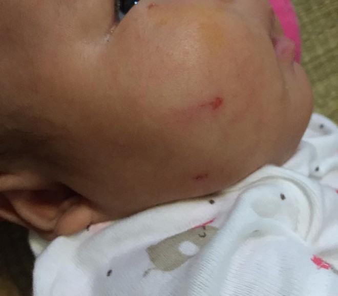 Hà Nội: Mẹ bận trong bếp, khỉ bất ngờ trèo lan can vào nhà cào mặt con gái 2 tháng tuổi - Ảnh 2.