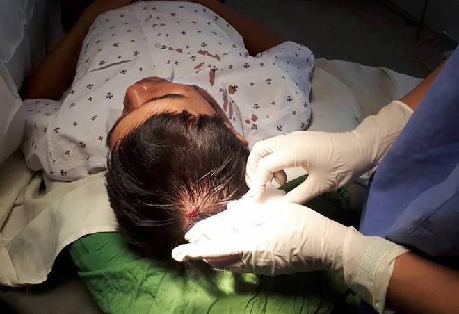Một bác sĩ bị nam thanh niên đi cùng bệnh nhân cấp cứu đánh chảy máu đầu - Ảnh 1.