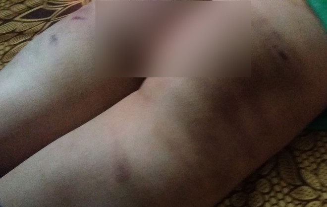 Vụ bé trai bị bạo hành ở Đông Anh - Hà Nội: Người mẹ làm đơn xin hòa giải cho chồng cũ - Ảnh 2.
