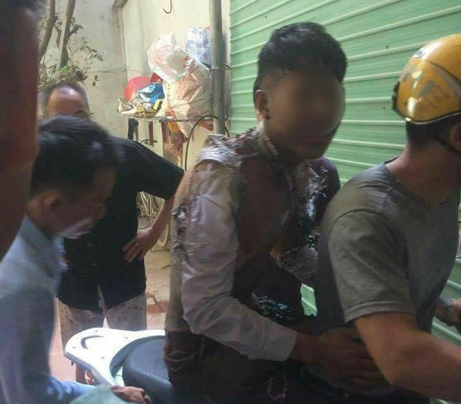 Bắc Ninh: Nam thanh niên bị bỏng toàn thân, nghi tự thiêu vì mâu thuẫn với bạn gái - Ảnh 1.