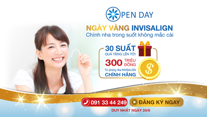 Niềng răng không mắc cài trong suốt nhận quà khủng lên tới 300 triệu - Ảnh 3.