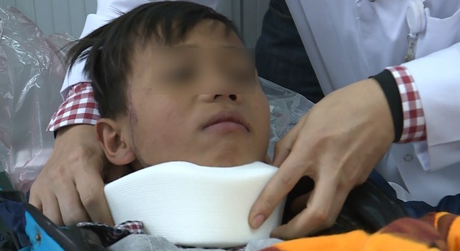 Vụ sập lan can trường tiểu học ở Bắc Ninh: 2 học sinh nặng nhất đã tỉnh táo nhưng vẫn phải theo dõi thêm - Ảnh 1.