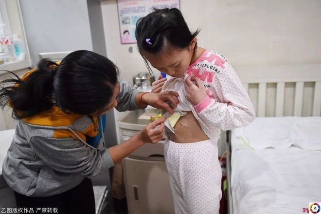“Con không muốn trở thành gánh nặng của bố mẹ, không có con thì vẫn còn anh và em mà, bé gái 14 tuổi muốn từ bỏ trị bệnh vì gia đình quá nghèo - Ảnh 3. “Con không muốn trở thành gánh nặng của bố mẹ, không có con thì vẫn còn anh và em mà, bé gái 14 tuổi muốn từ bỏ trị bệnh vì gia đình quá nghèo - Ảnh 3.