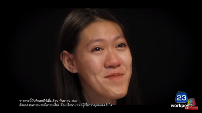 7 màn thoát xác ngoạn mục này của Thái Lan sẽ chứng minh cho bạn thấy nếu nói về làm đẹp, không gì là không thể! - Ảnh 14.