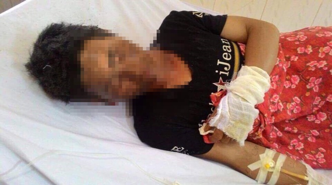 Lào Cai: Nổ khí gas, 10 người bị bỏng, trong đó bé gần 1 tuổi bỏng nặng - Ảnh 2. Lào Cai: Nổ khí gas, 10 người bị bỏng, trong đó bé gần 1 tuổi bỏng nặng - Ảnh 2.