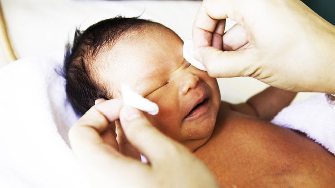 Mắt trẻ sơ sinh dưới 6 tháng bị ghèn khiến mẹ phải ra tay với 3 cách chăm sóc giúp bệnh nhẹ hóa không này - Ảnh 1.