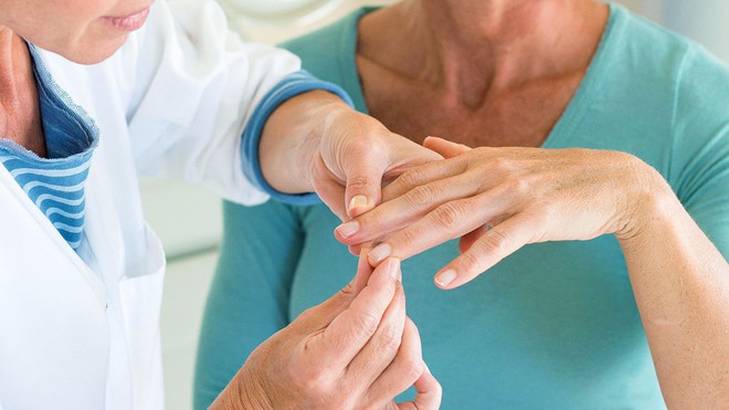 Bệnh vẩy nến khiến không ít người khổ sở và đây là những điều cần biết để phòng tránh - Ảnh 2. Bệnh vẩy nến khiến không ít người khổ sở và đây là những điều cần biết để phòng tránh - Ảnh 2.