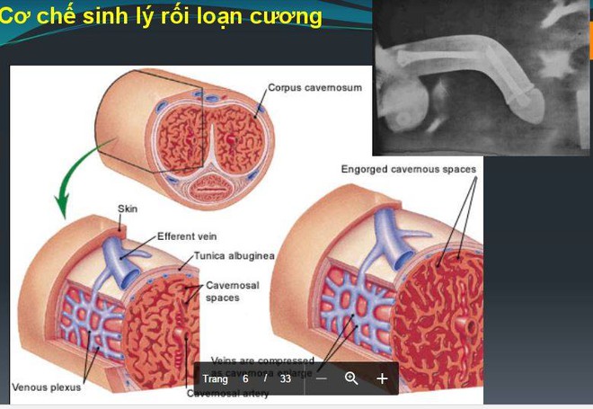 2 rắc rối lớn trong chuyện thầm kín mà không ít cặp đôi đang âm thầm chịu đựng - Ảnh 5.