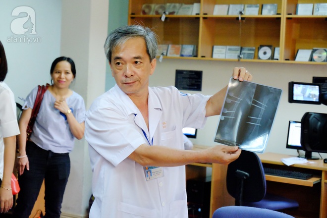 TP.HCM: Bác sĩ Việt cứu sống em bé Campuchia bị suy thận cấp do té cây hiếm gặp - Ảnh 1.