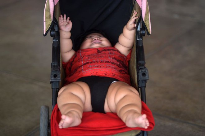 Con 10 tháng nặng 28kg, mẹ đinh ninh con hấp thụ sữa mẹ tốt mà không ngờ mắc bệnh đặc biệt - Ảnh 1.