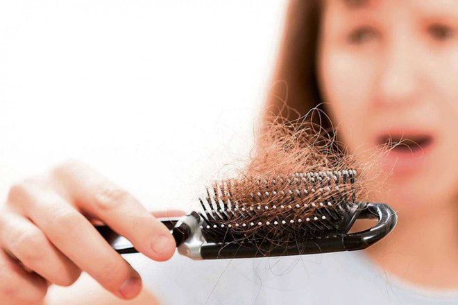 Nếu chê mùi hăng mà từ chối bôi nước hành tây lên đầu, bạn đã bỏ qua một cách chăm sóc tóc tuyệt vời - Ảnh 1.