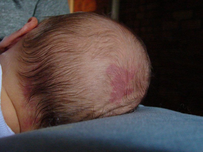 Có những hiện tượng ở trẻ sơ sinh, tưởng bất thường nhưng hoàn toàn bình thường - Ảnh 12.