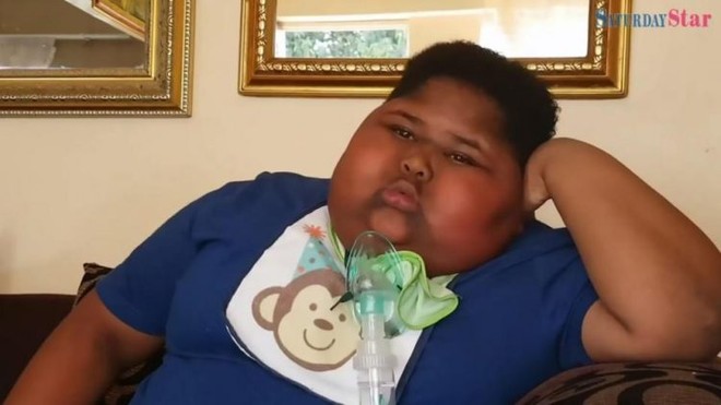 Mới 10 tuổi cậu bé này đã nặng gần 100kg, ăn cả giấy vệ sinh vì không thấy no - Ảnh 1.