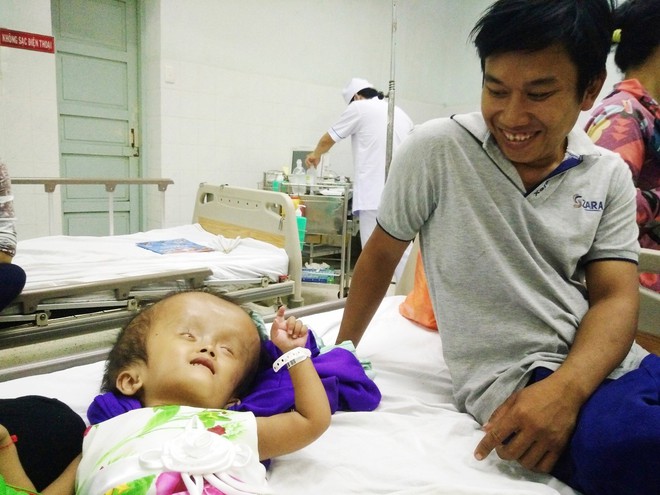 Xót cảnh bé gái 4 tuổi bị não úng thủy, đầu to gấp ba lần người thường mà bố mẹ nghèo không tiền chạy chữa - Ảnh 6.