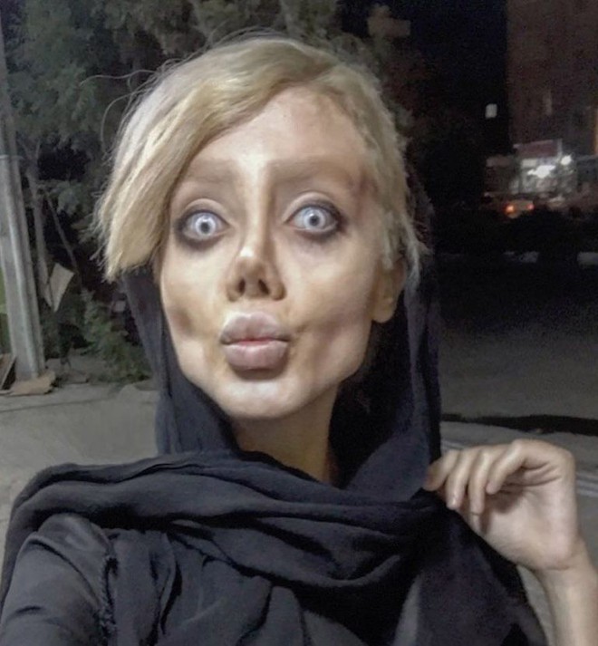 At the age of 19, she had plastic surgery 50 times to look like Angelina. 10 years later, her post-surgery appearance makes people freeze - Photo 4.