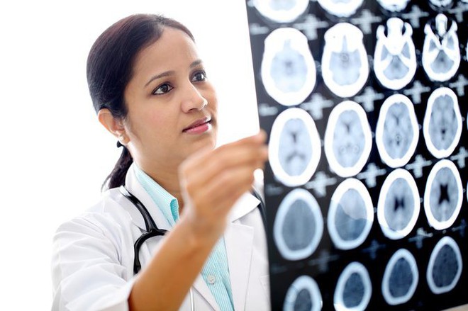 6 dấu hiệu cảnh báo có thể bạn đang có một khối u trong não - Ảnh 2.