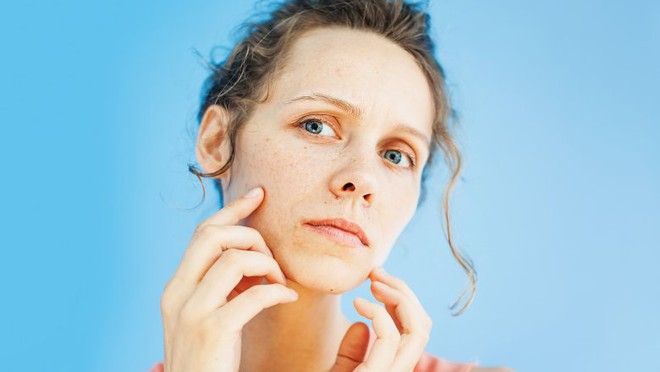 Điều gì thực sự xảy ra với da mặt khi bạn đi ngủ không tẩy trang - Ảnh 5.