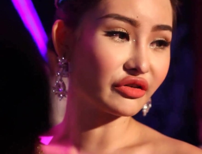 BTC Hoa hậu Đại dương khẳng định Ngân Anh không thẩm mỹ, Tân Hoa hậu giải thích môi sưng do dị ứng - Ảnh 3.