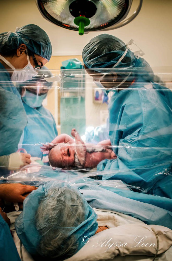 Màn chắn trong suốt: Điểm mới trong sinh mổ giúp mẹ tận mắt chứng kiến quá trình chào đời của con - Ảnh 4.