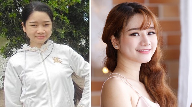 Bị bồ lạnh nhạt, cô gái Nha Trang quyết dao kéo đẹp hơn bội phần - Ảnh 1. Bị bồ lạnh nhạt, cô gái Nha Trang quyết dao kéo đẹp hơn bội phần - Ảnh 1.