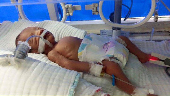 Thai phụ mang thai 7 tháng tử vong vì tai nạn giao thông, con chưa chào đời đã mồ côi mẹ - Ảnh 1.