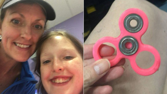 Cảnh giác: Một người mẹ suýt mất con gái 8 tuổi chỉ vì món đồ chơi thời thượng spinner - Ảnh 3.