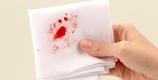 Chảy máu bất thường trên cơ thể: dấu hiệu cảnh báo sức khỏe bạn không nên xem thường - Ảnh 3.