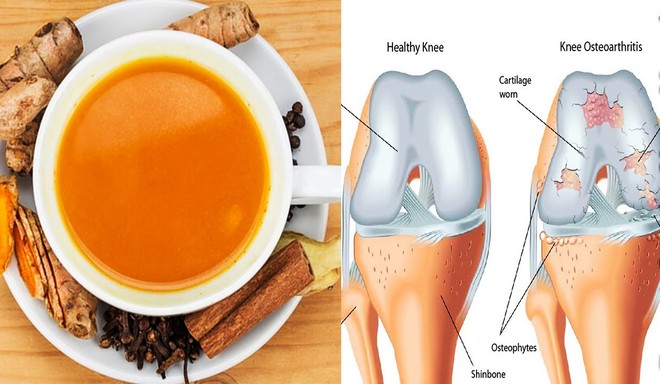 Xuất hiện nhiều trong những bài thuốc của cha mẹ, nghệ quả thực là “danh bất hư truyền” với 18 công dụng đặc biệt - Ảnh 7.