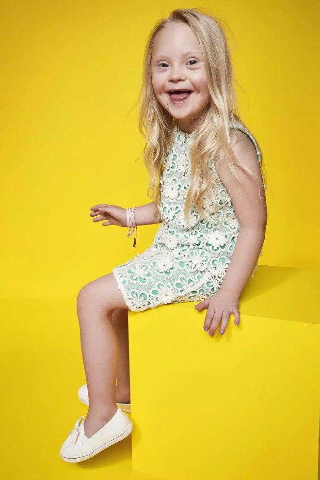 Trẻ em khuyết tật trở thành người mẫu chuyên nghiệp trong chiến dịch mới của thương hiệu thời trang - Ảnh 2.