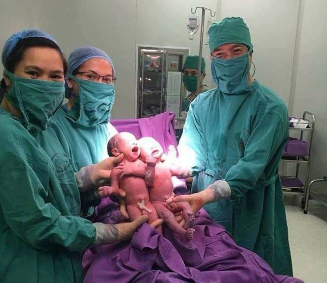 Hai bé trai được sinh cùng trứng từ thụ tinh nhân tạo tại BV Quảng Ninh - Ảnh 2.