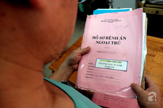 Tết trong bệnh viện của những đứa trẻ chạy thận: Tay sưng vù vì vết kim châm - Ảnh 14. Tết trong bệnh viện của những đứa trẻ chạy thận: Tay sưng vù vì vết kim châm - Ảnh 14.