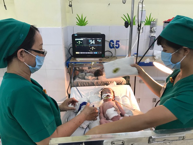 Bất ngờ chuyển dạ trên đường xuống Sài Gòn, sản phụ sinh bé gái bị lòi ruột ngoài ổ bụng nguy kịch - Ảnh 1.