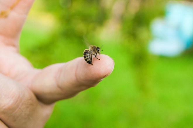 Tử vong do chữa bệnh bằng cách cho ong đốt - Lời cảnh tỉnh cho người muốn chữa bệnh bằng nọc ong - Ảnh 2.